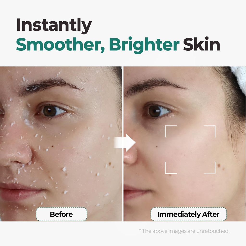 MOTHER MADE LHA Green Tea Exfoliating Aqua Peel Gel – Pore Care, Gentle Facial Exfoliator, 2 Pack (100ml each) | Vegan, Korean Skincare