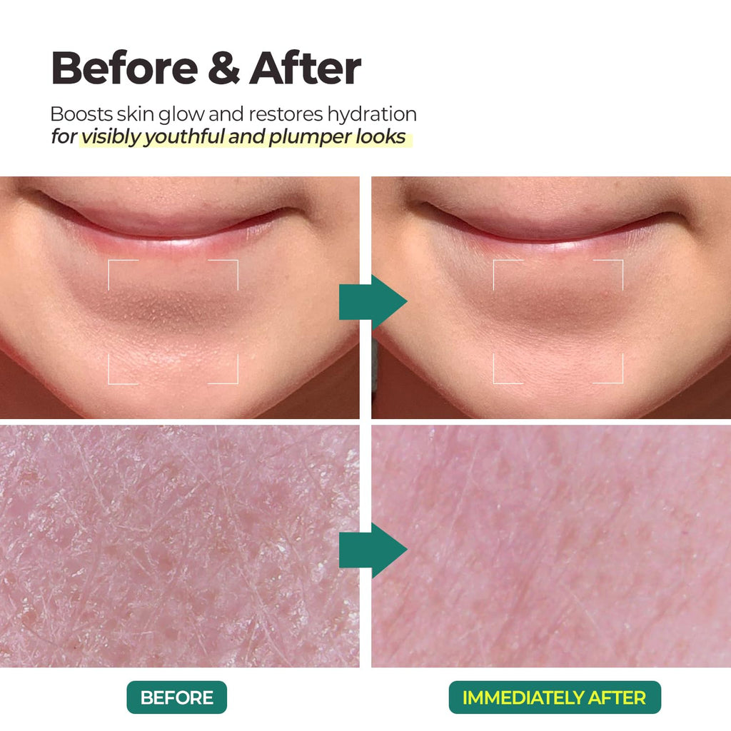 MOTHER MADE LHA Green Tea Aqua Peel Gel | Gentle Exfoliating Face Gel for Deep Pores