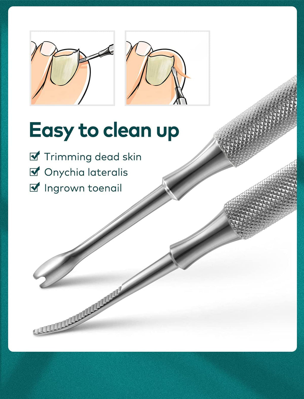 MR.GREEN Nail Clippers for Thick & Ingrown Toenails – Heavy-Duty Paronychia Tools