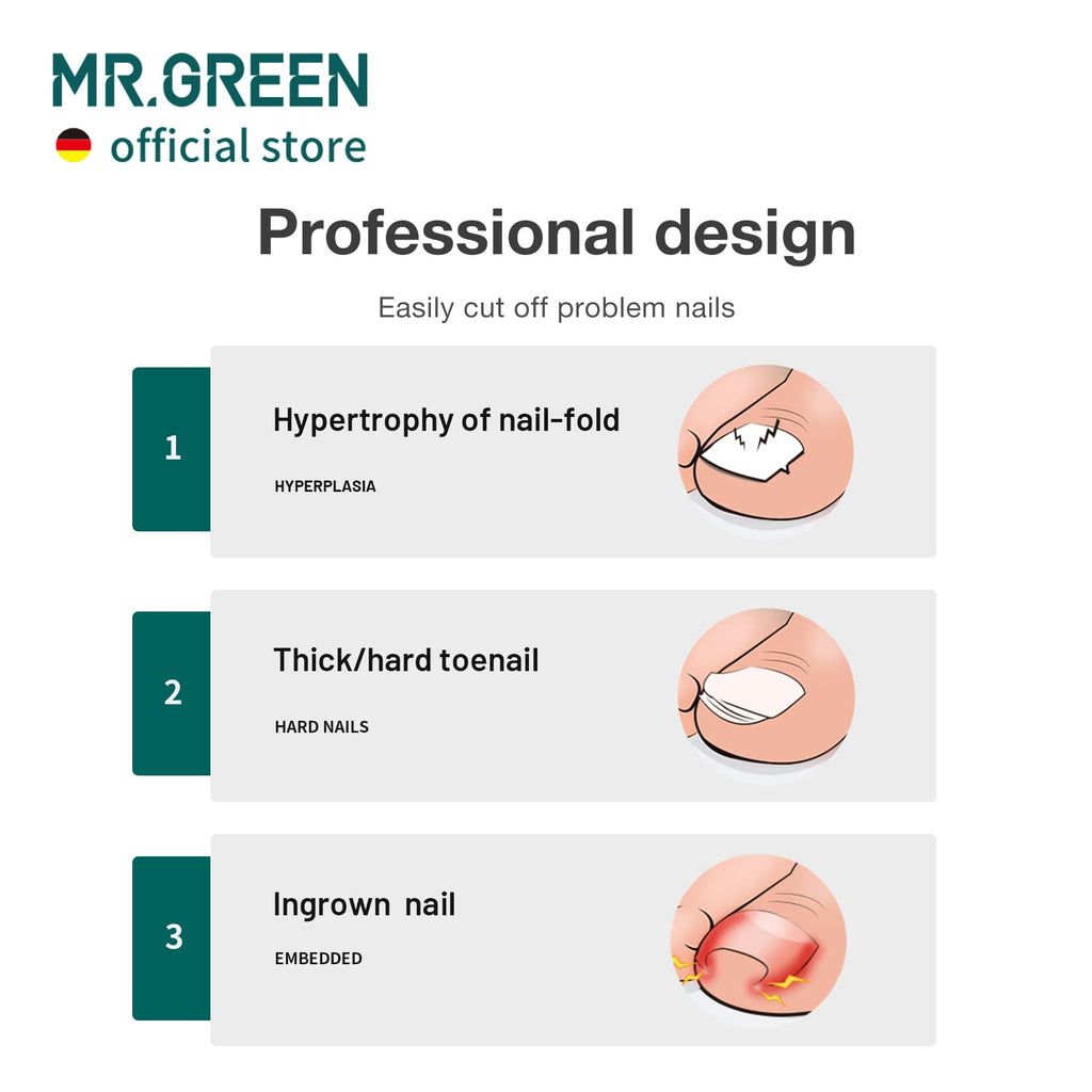 MR.GREEN Toenail Clippers – Stainless Steel Ingrown Nail Cutter for Thick Nails (Orange)