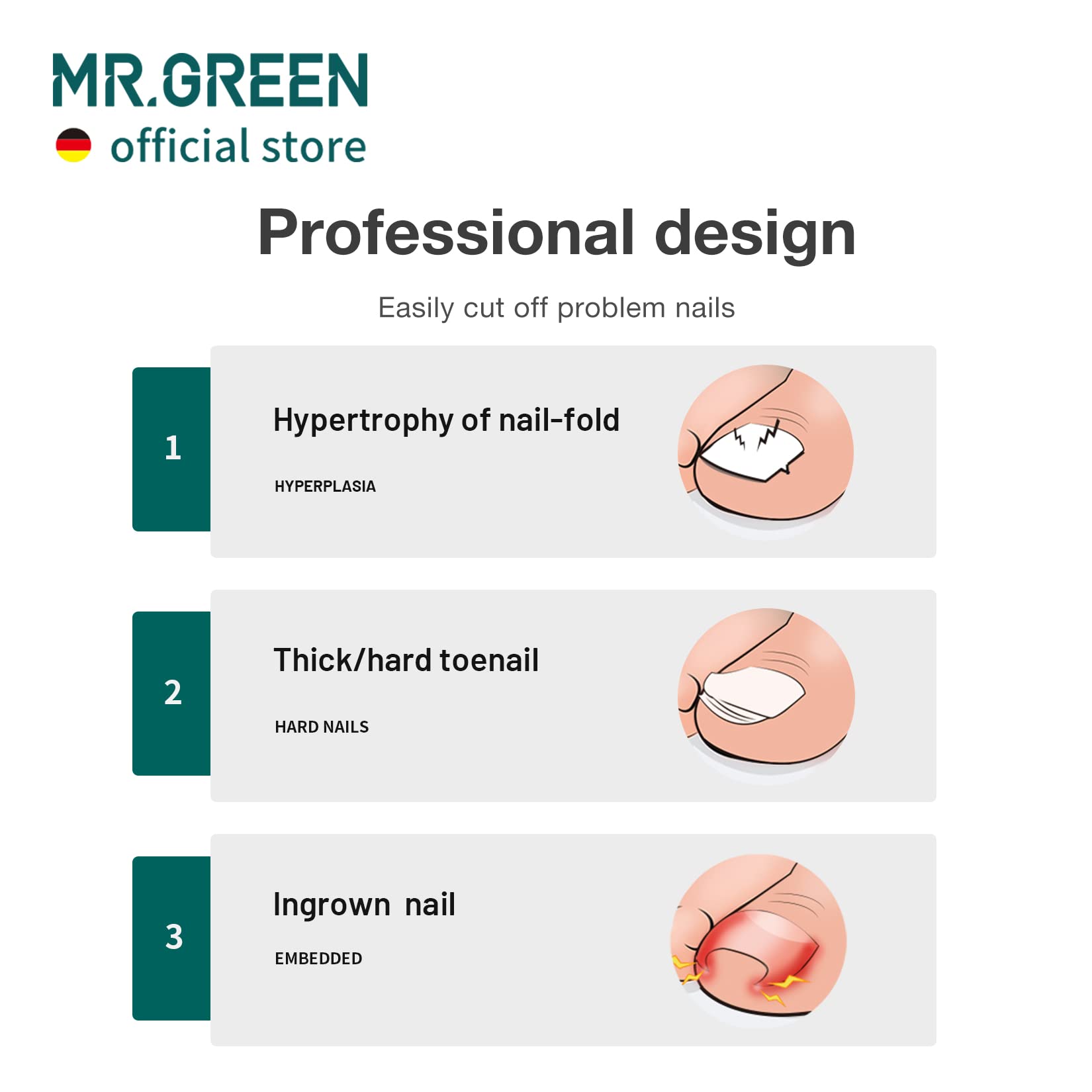 MR.GREEN Toenail Clippers – Stainless Steel Ingrown Nail Cutter for Thick Nails (Orange)