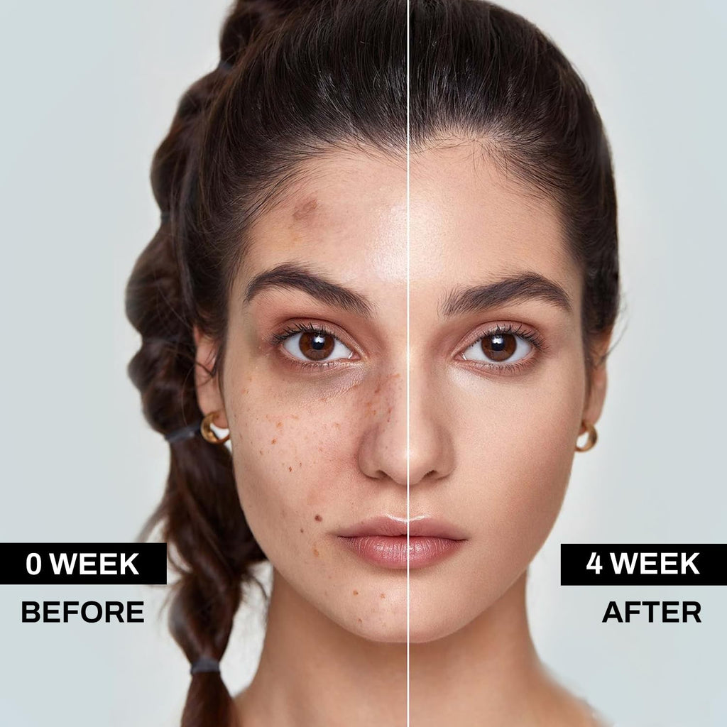 Mrkayll Dark Spot Remover for Face – Fade Sun Spots & Melasma