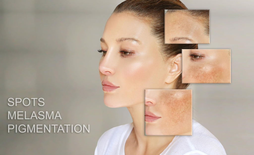 MT SKIN CLINIC Pro Intense Anti Aging Day Cream – Hydration, Redness Relief & Sensitive Skin Support