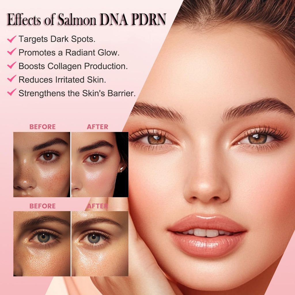 Mtmult Salmon DNA PDRN Serum – 99% Salmon DNA, Collagen & Hyaluronic Acid, 30 Ampoules, Firming & Moisturizing