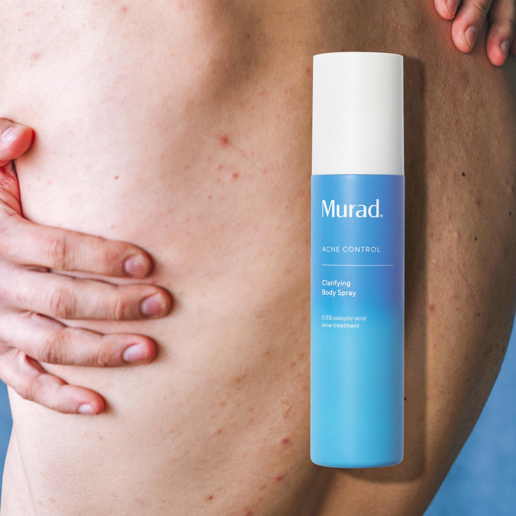Murad Clarifying Body Spray - Daily Salicylic Acid Treatment, 6 fl oz