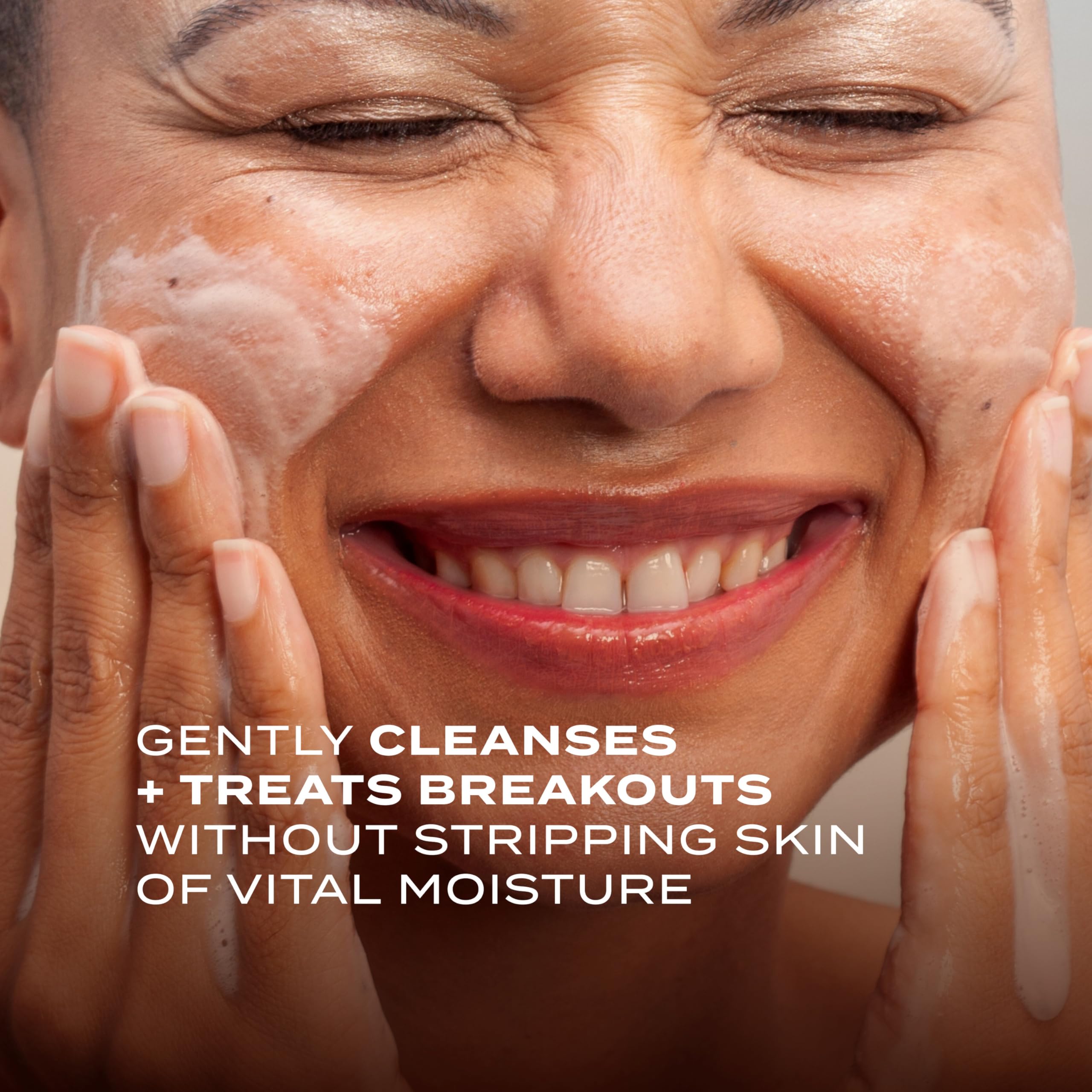 Murad Acne Control Clarifying Cream Cleanser | Gentle Salicylic Acid Face Wash for Acne-Prone Skin