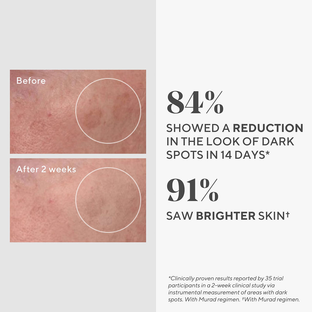 Murad Rapid Dark Spot Correcting Serum | Skin Brightening Serum for Hyperpigmentation – Glycolic Acid (0.33 oz Travel Size)