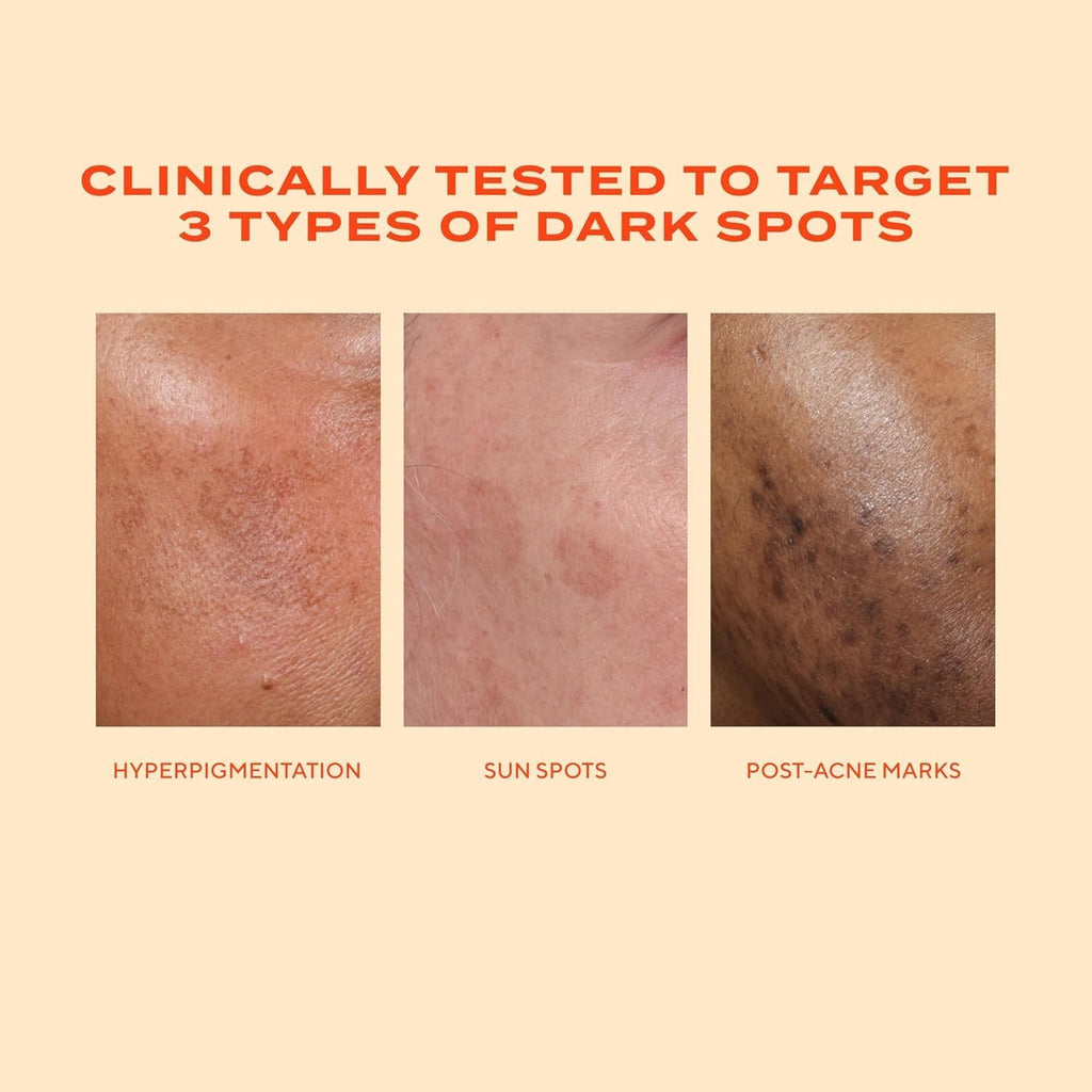Murad Rapid Dark Spot Correcting Serum — Advanced Resorcinol, Tranexamic & Glycolic Formula | 1 fl oz