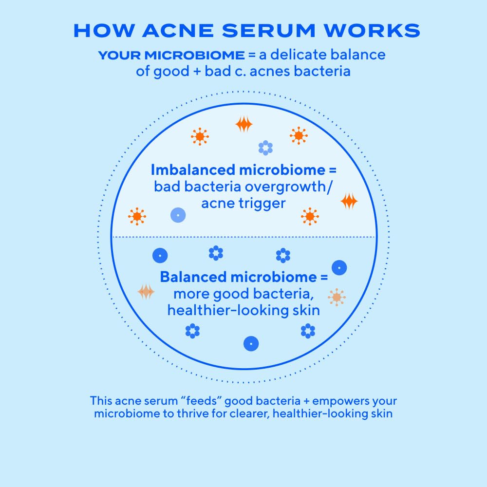 Murad Biome-Balancing Acne Treatment Serum – Salicylic, Mandelic & Glutamic Acids | 1.0 fl oz
