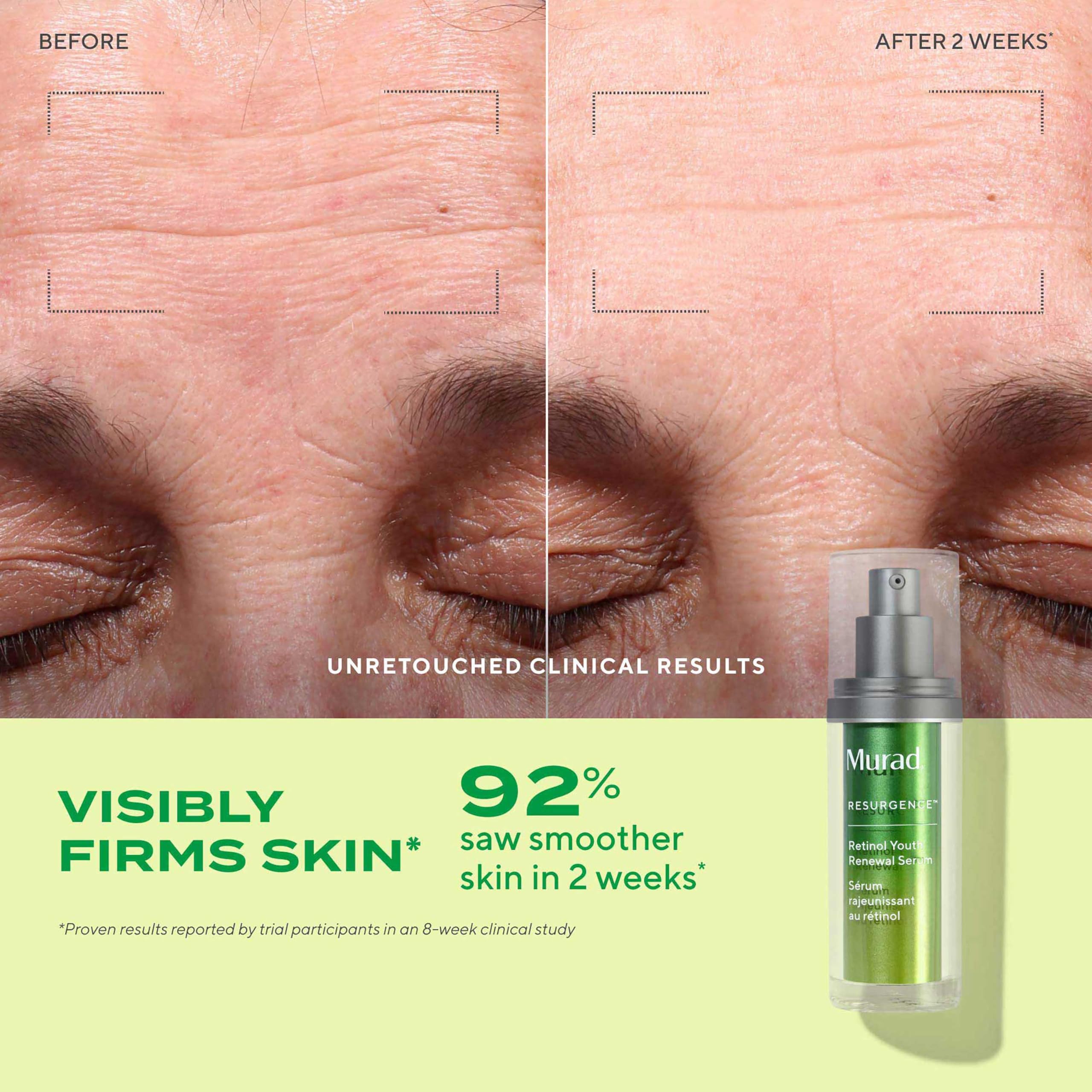 Murad Youth Renewal Retinol Trial Kit – 3-Piece Anti-Aging Set