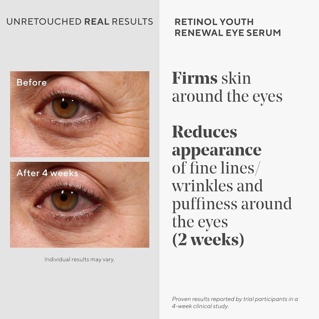 Murad Youth Renewal Retinol Trial Kit – 3-Piece Anti-Aging Set