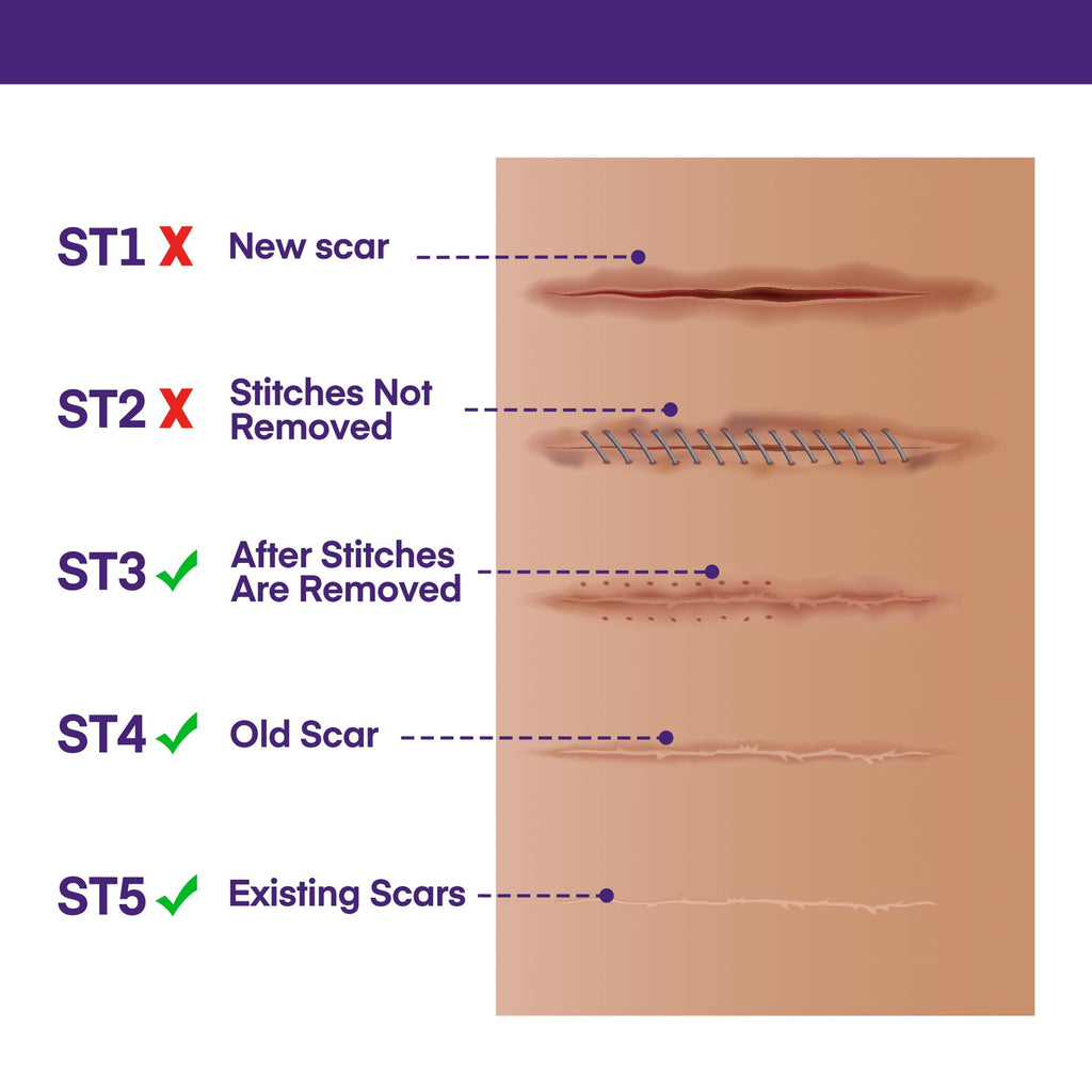 MURASAKI BEAUTY Silicone Scar Gel SPF 30 – Advanced Medical-Grade Scar Cream 1.06oz