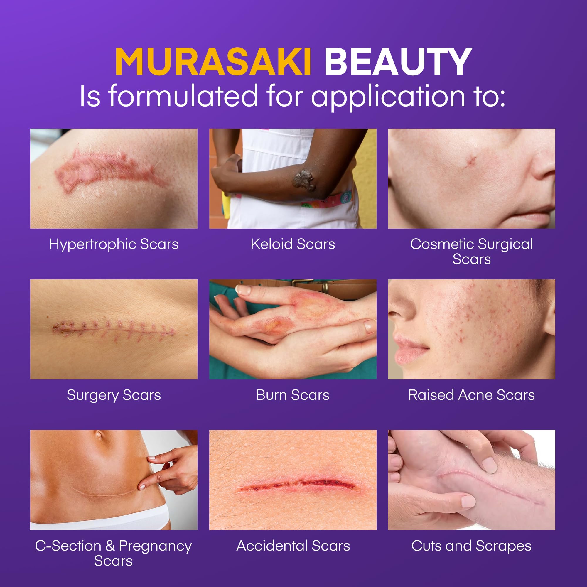 MURASAKI BEAUTY Silicone Scar Gel SPF 30 – Advanced Medical-Grade Scar Cream 1.06oz
