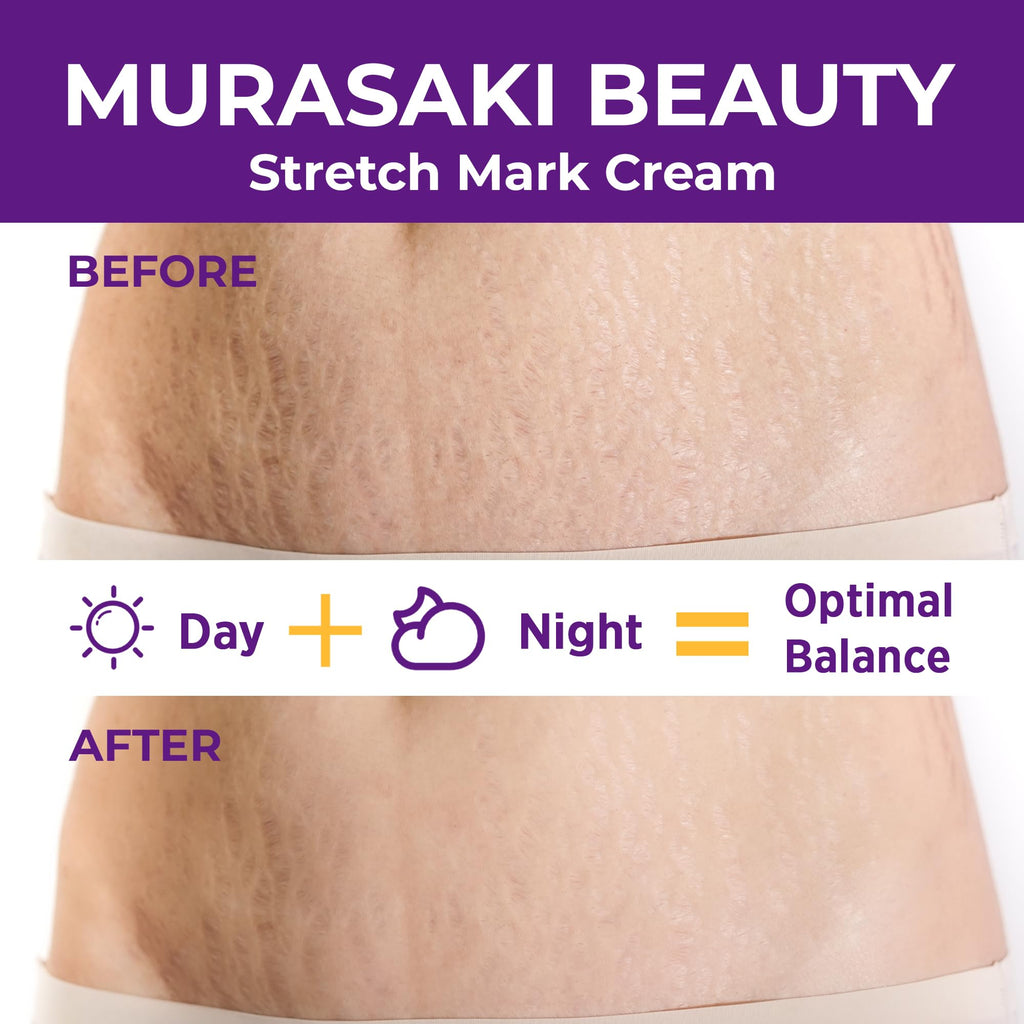 Murasaki Beauty Stretch Mark Cream for Pregnancy – 2 Pack Maternity Cream for Prevention & Elasticity (4 oz)