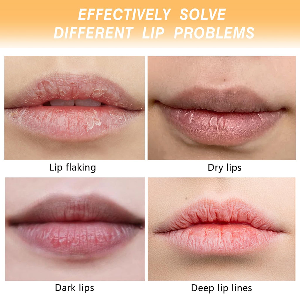 MUREND 3PCS Turmeric Lip Balm for Smokers – Dark Lip Treatment, Lip Exfoliator & Nourishing Moisturizer