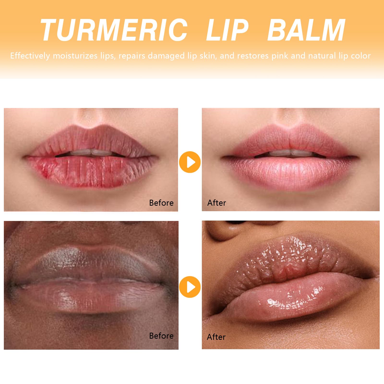 MUREND 3PCS Turmeric Lip Balm for Smokers – Dark Lip Treatment, Lip Exfoliator & Nourishing Moisturizer