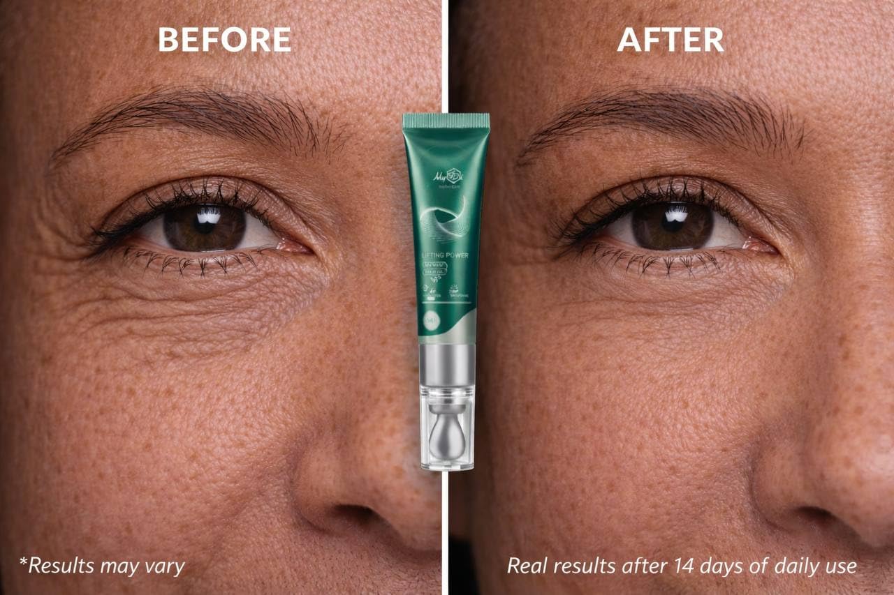 MyIDi Lifting Power Eye Fluid – Hydrating Anti-Aging Serum