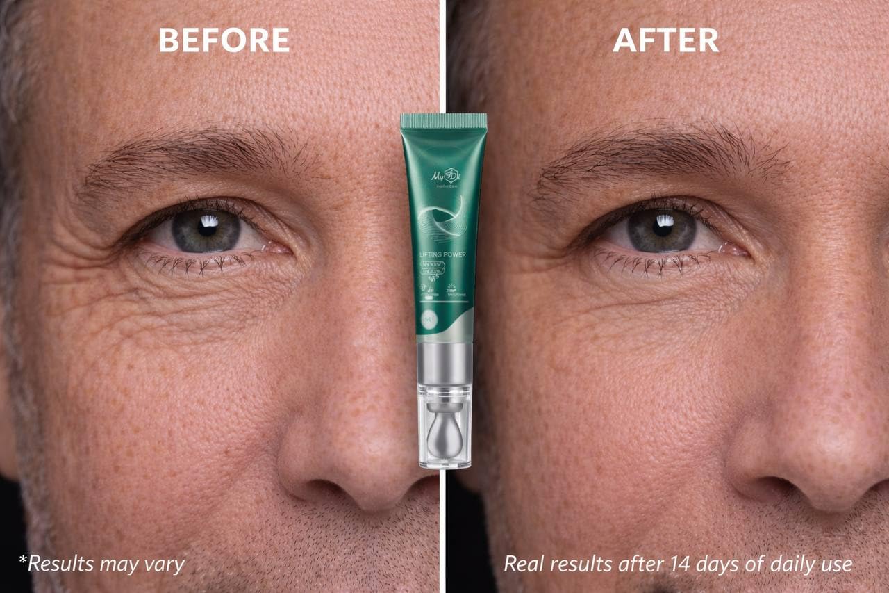 MyIDi Lifting Power Eye Fluid – Hydrating Anti-Aging Serum