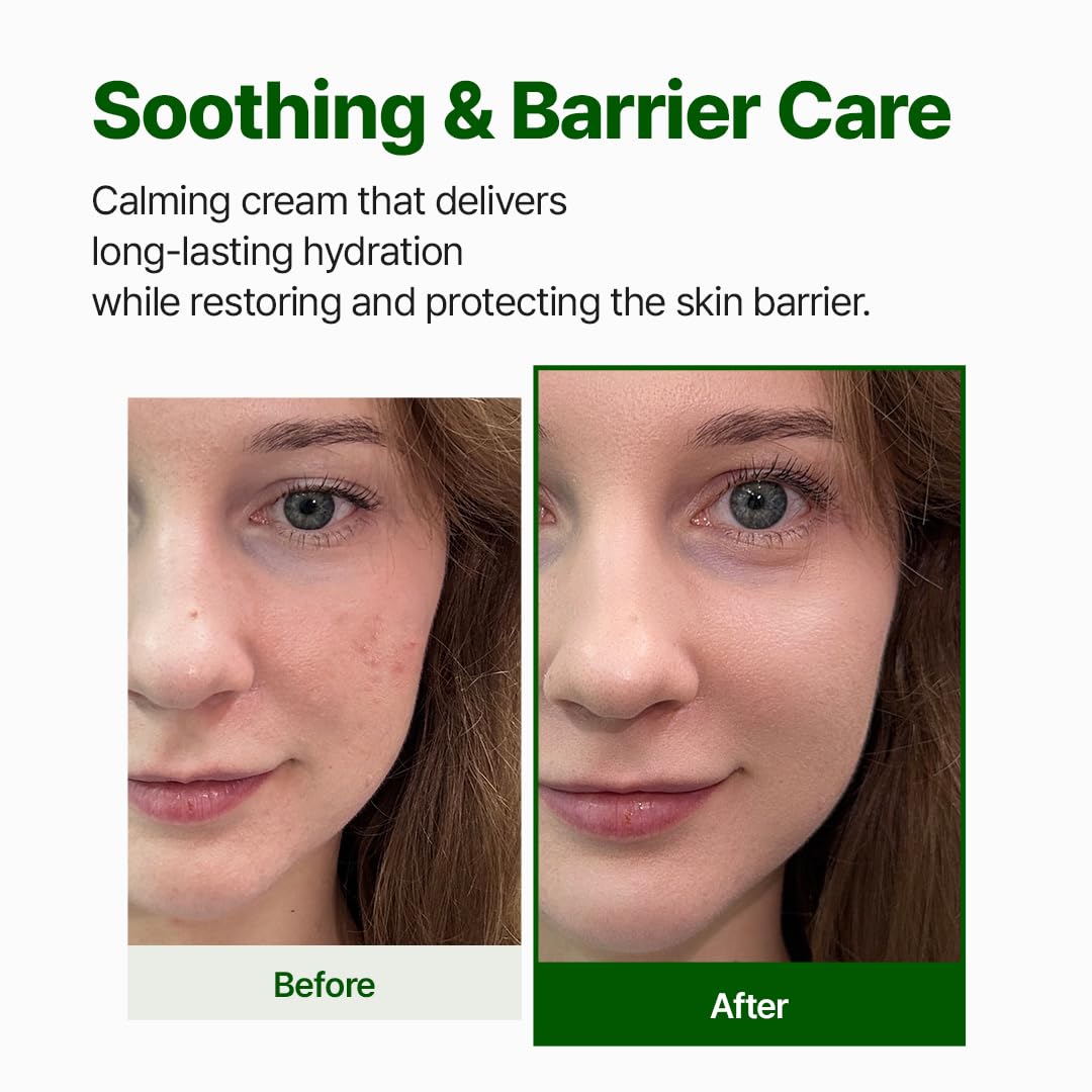 NACIFIC Cica PDRN Barrier Repair Cream – 76% Centella, Deep Hydration
