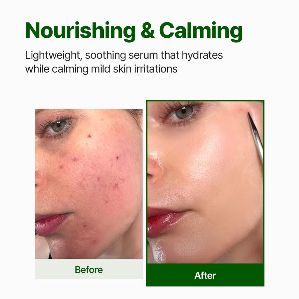 NACIFIC Cica PDRN Centella Serum – Calming, Hydrating Centella Ampoule for Sensitive Skin (50ml)