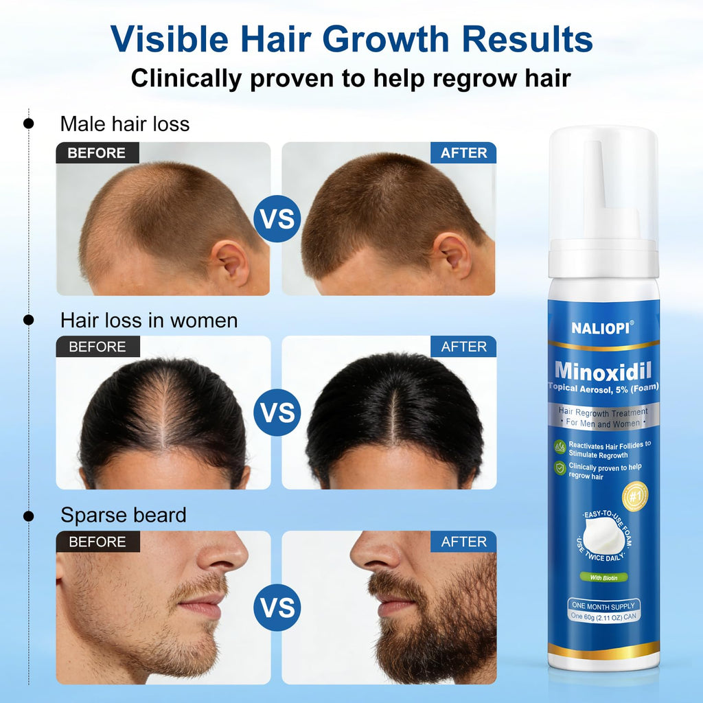 NALIOPI 8-Pack 5% Minoxidil Foam for Hair Regrowth – Biotin-Infused, Unscented, 60ml bottles (8-Month Supply)