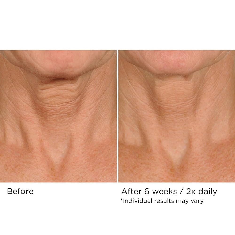 NassifMD Deco-Lift Neck Firming Complex Serum | Hydration & Smoothing