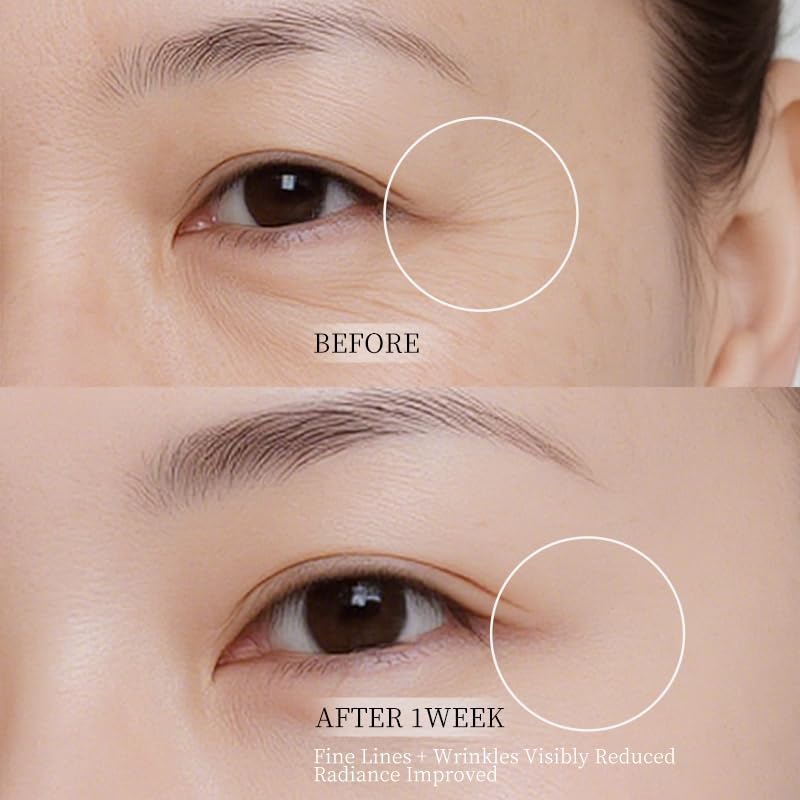 Natener 5% PDRN Eye Cream Patch – DIY Under Eye Patches for Puffy Eyes, Dark Circles & Wrinkles