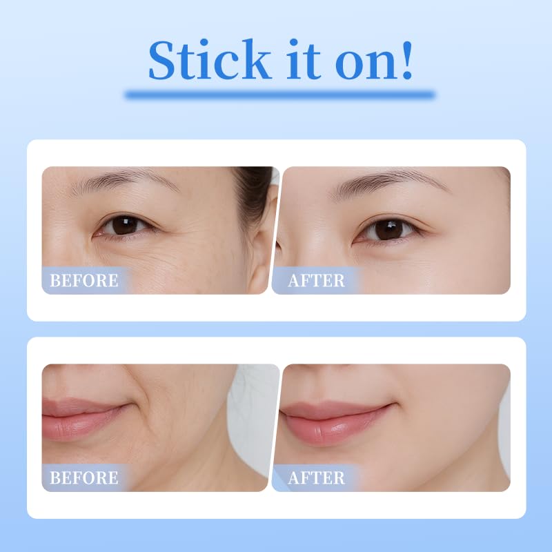 Natener 8 PDRN Micro Eye Patches | Puffy Eyes, Dark Circles & Wrinkles