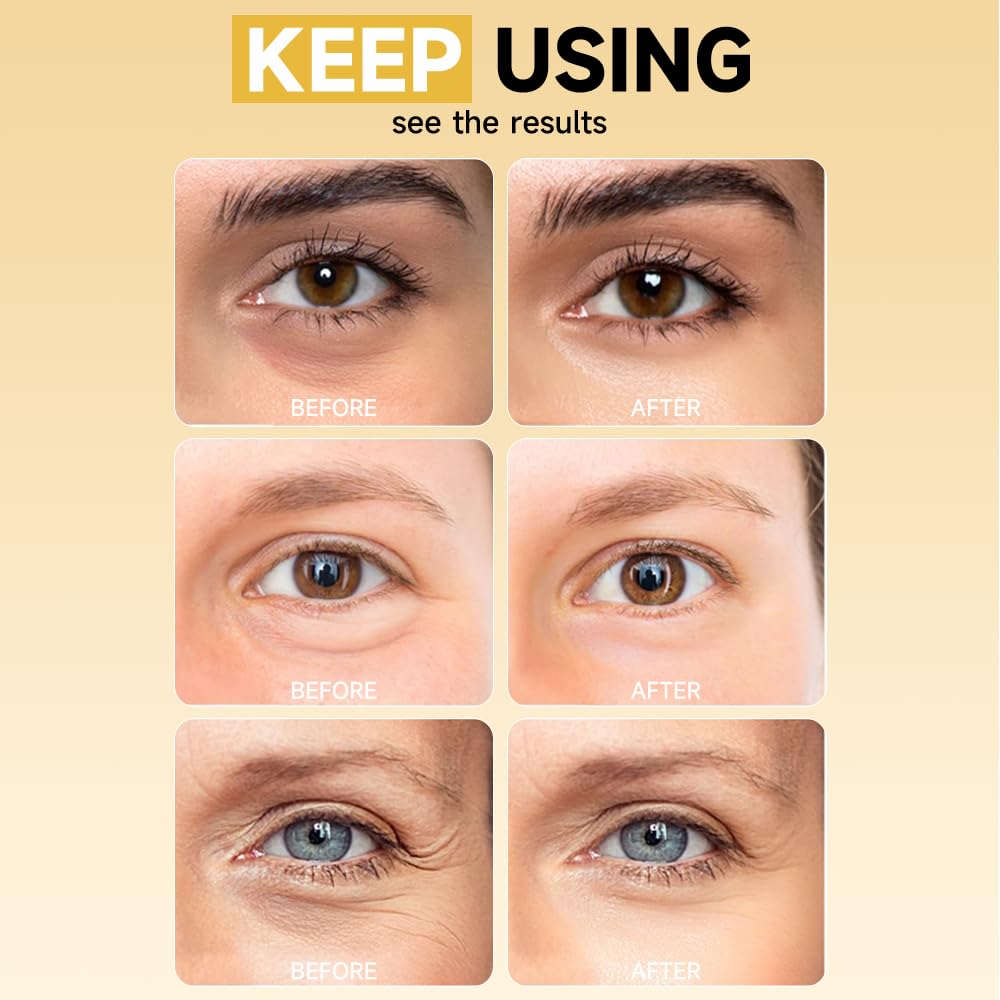 Natener 8 Pairs 5% PDRN Under Eye Patches – 6-in-1 Bio-Collagen 360° Korean Eye Care
