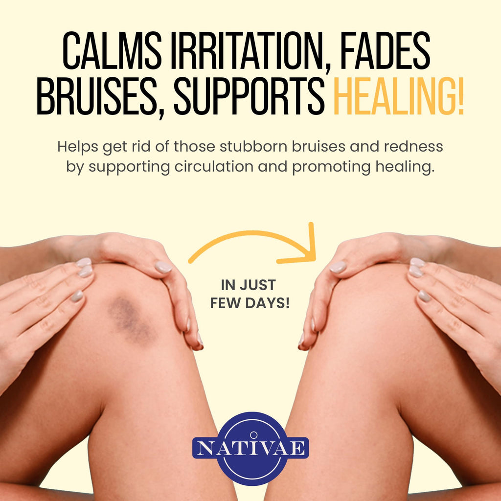 Nativae Helichrysum Balm – Helichrysum Italicum Essential Oil Skin Cream for Bruises, Veins, Burns & Redness – Soothing Moisturizer for Face & Body