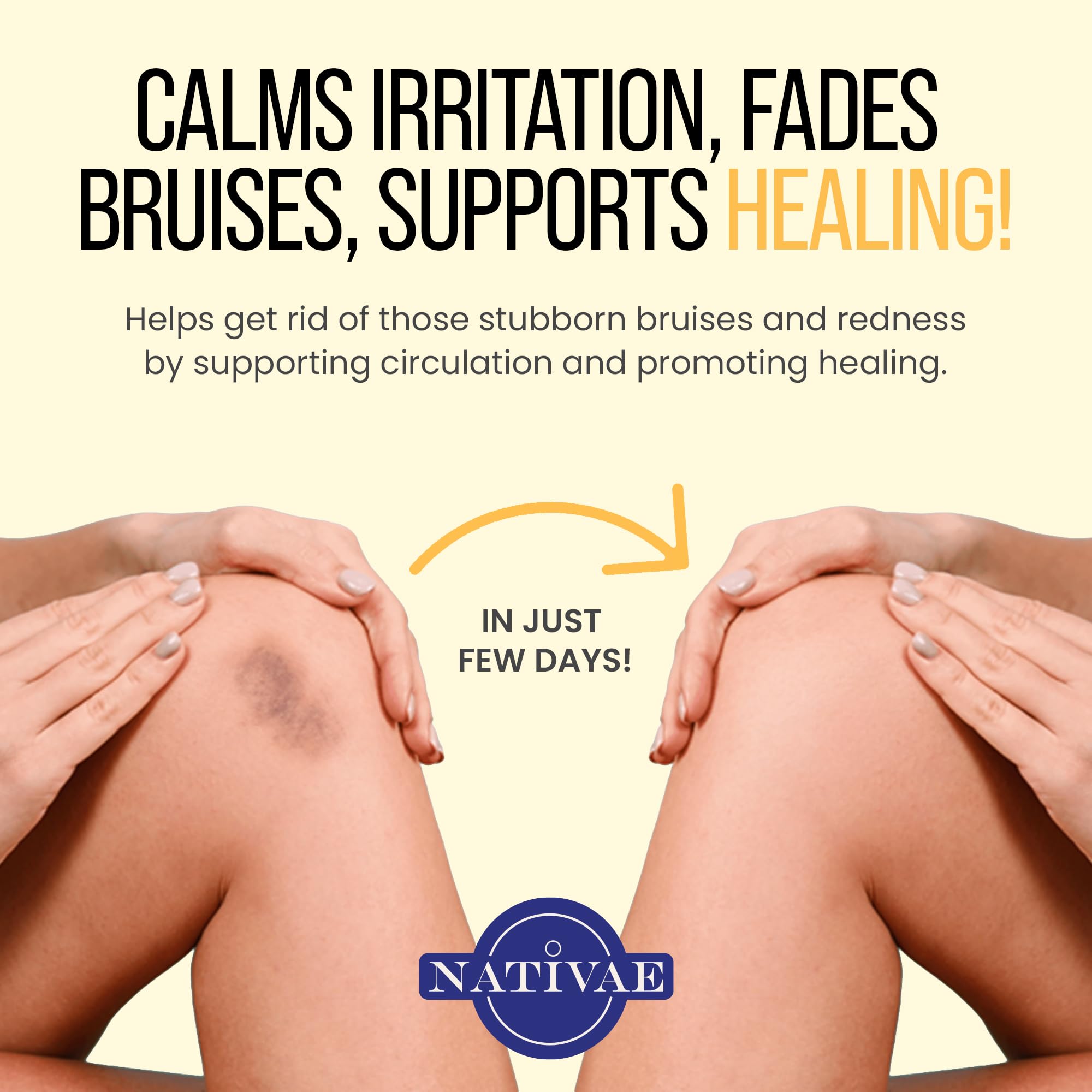 Nativae Helichrysum Balm – Helichrysum Italicum Essential Oil Skin Cream for Bruises, Veins, Burns & Redness – Soothing Moisturizer for Face & Body