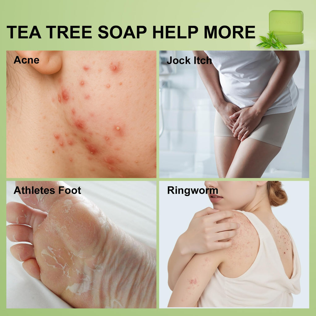 Natouch Antifungal Antibacterial Soap Bar – Tea Tree Oil, Face & Body, 2-Pack, 8 oz