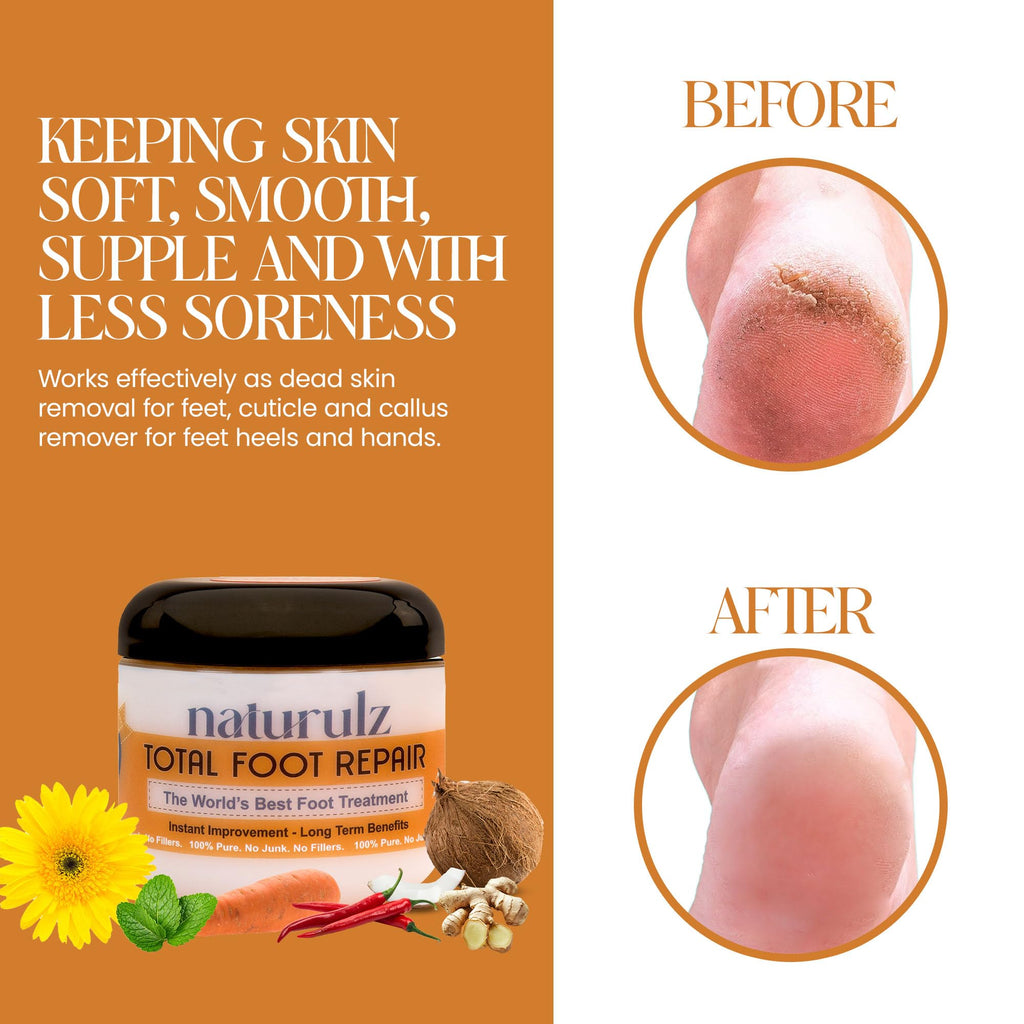 Naturulz Total Foot Repair 4oz – Intensive Moisture Foot Cream for Dry, Rough Skin & Cracked Heels