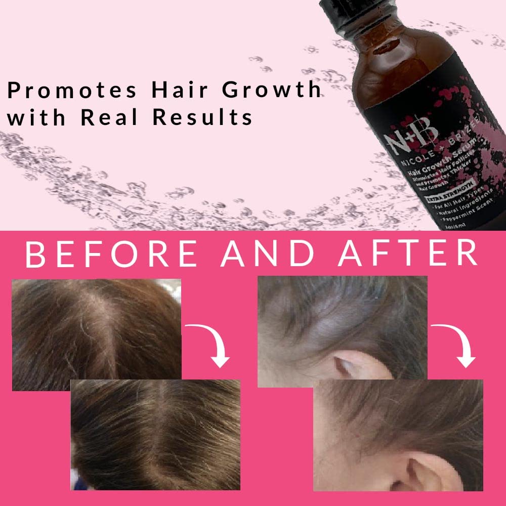 N+B Hair Growth Serum by Nicole + Brizee – Thicker, Fuller Hair (2 oz) 3-Pack
