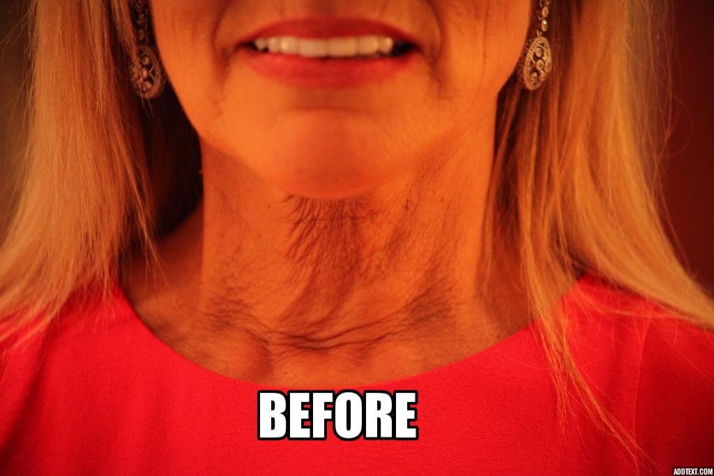 NeckTITE Magic - Instant Neck Lift