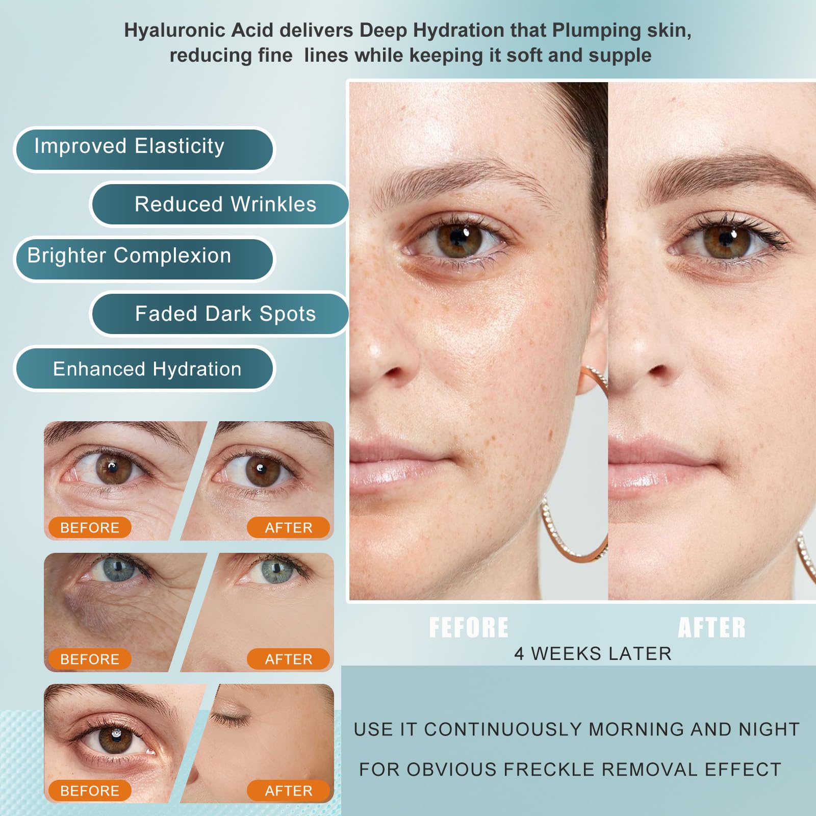 NEIOM Vitamin C Serum with Hyaluronic Acid & Tri-Peptide - Anti-Aging Hydration & Dark Spot Corrector, 1 fl oz