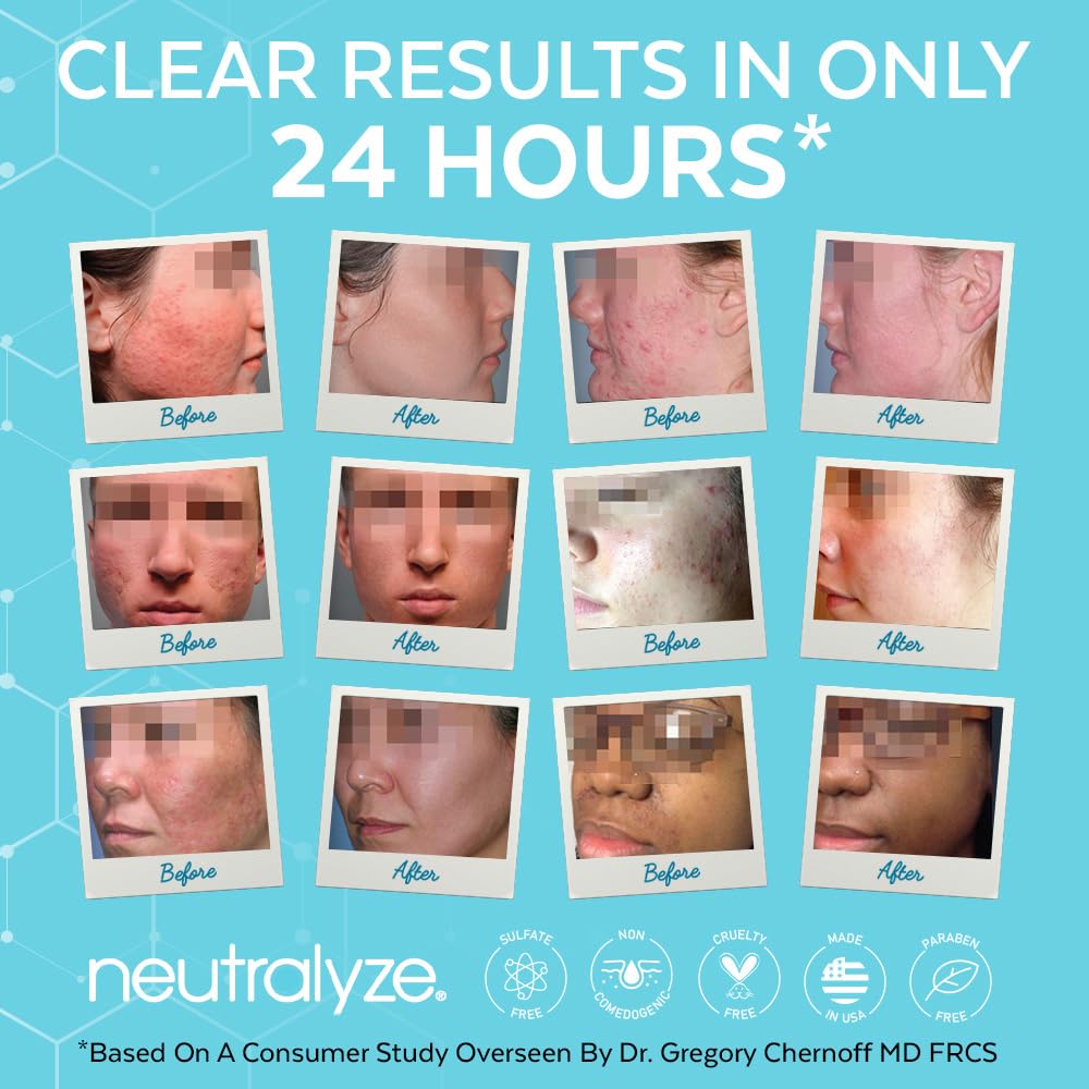 Neutralyze Moderate To Severe Acne Treatment Kit 2.0 – Clearing Serum & Synergyzer