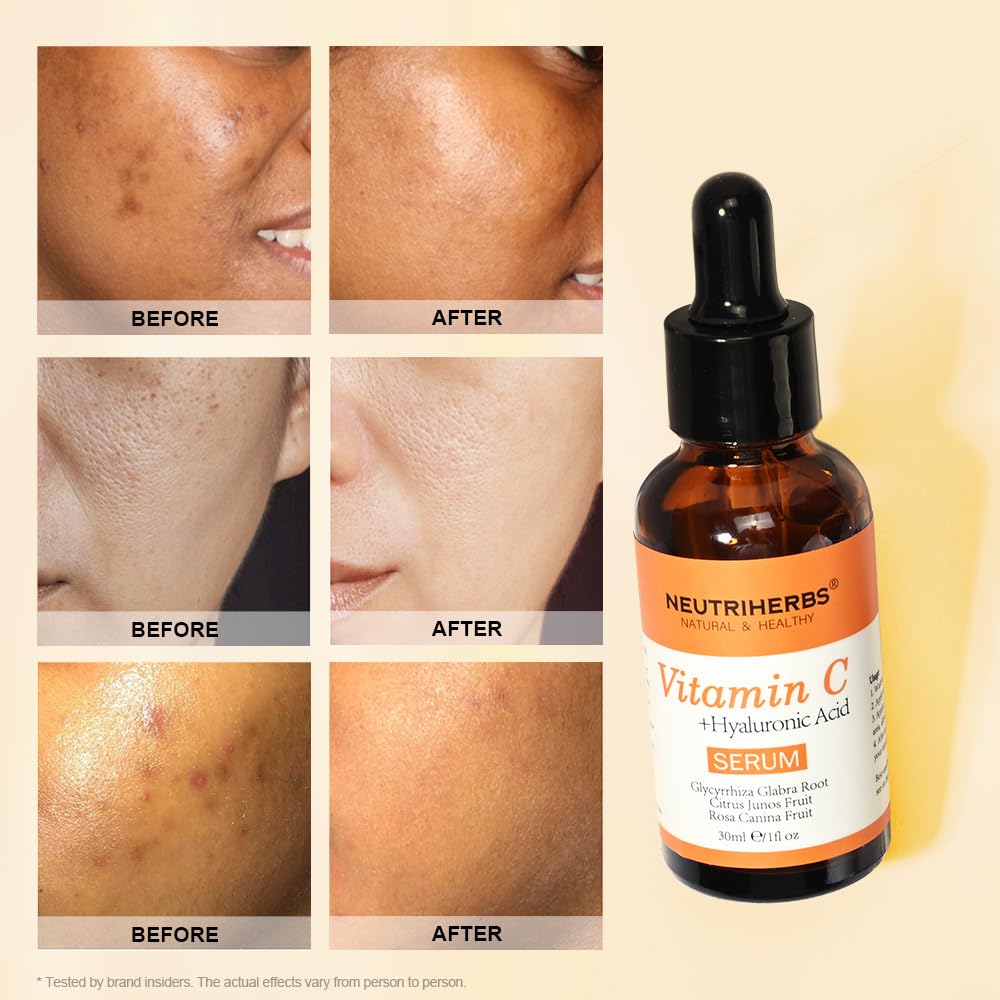 Neutriherbs Vitamin C Serum with Hyaluronic Acid – Anti-Aging, Brightening & Hydrating Facial Serum (1 fl oz)