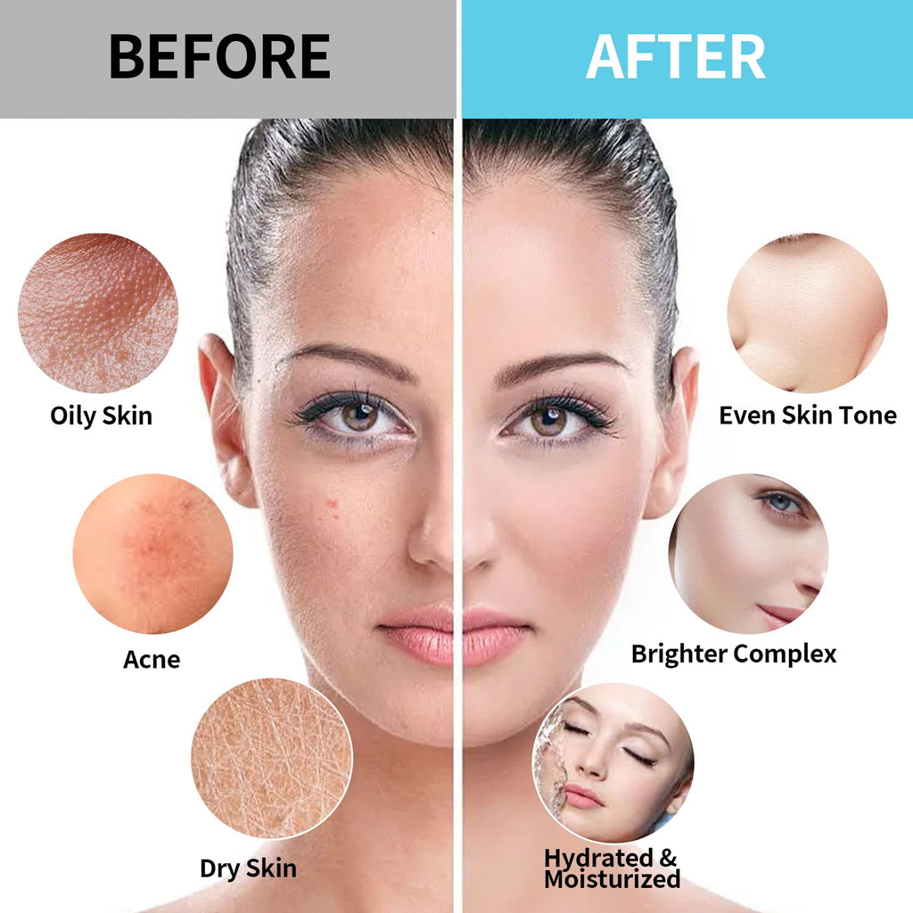 Nielies Fresh Mint Jelly Mask – Peel-Off Facial for Instant Hydration & Smoothing