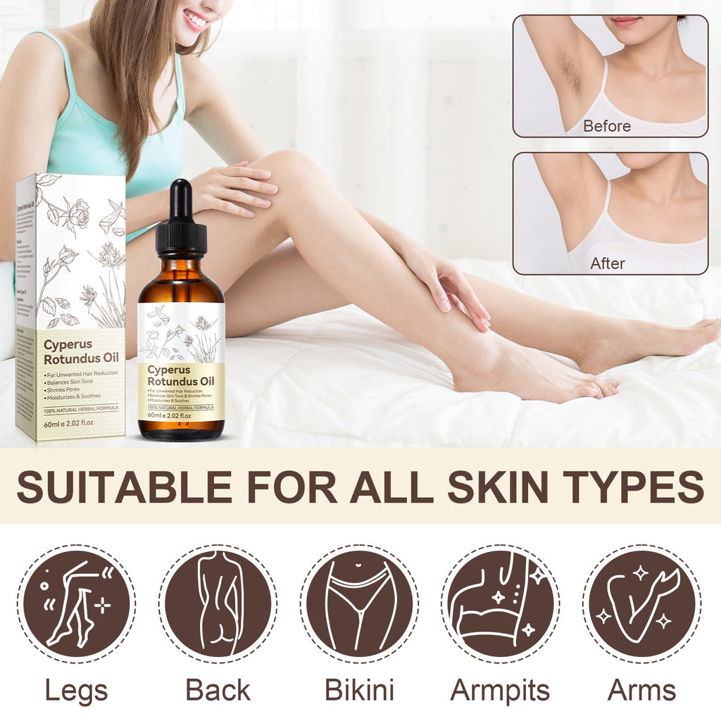 NIFEISHI Cyperus Rotundus Oil for Hair Removal – Gentle, Moisturizing Formula (60ml)