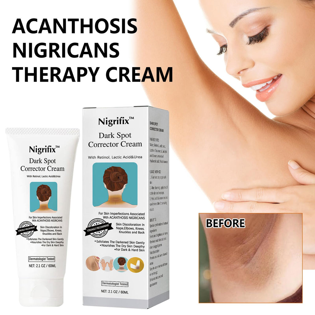 Nigrifix Acanthosis Nigricans Therapy Cream – Dark Spot Corrector for Body | Underarms, Neck & More | 2.1 Fl Oz