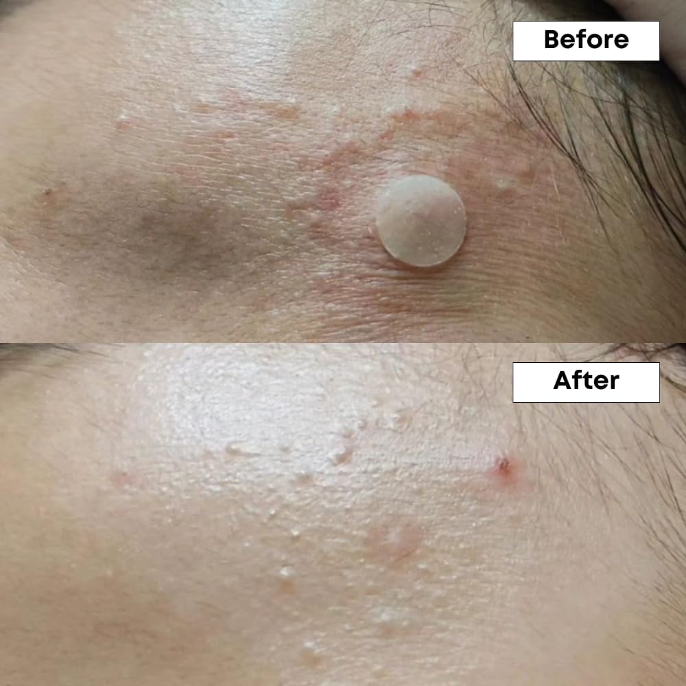 NINELESS A-Control 10% Azelaic Acid Serum – Even Tone & Refined Texture