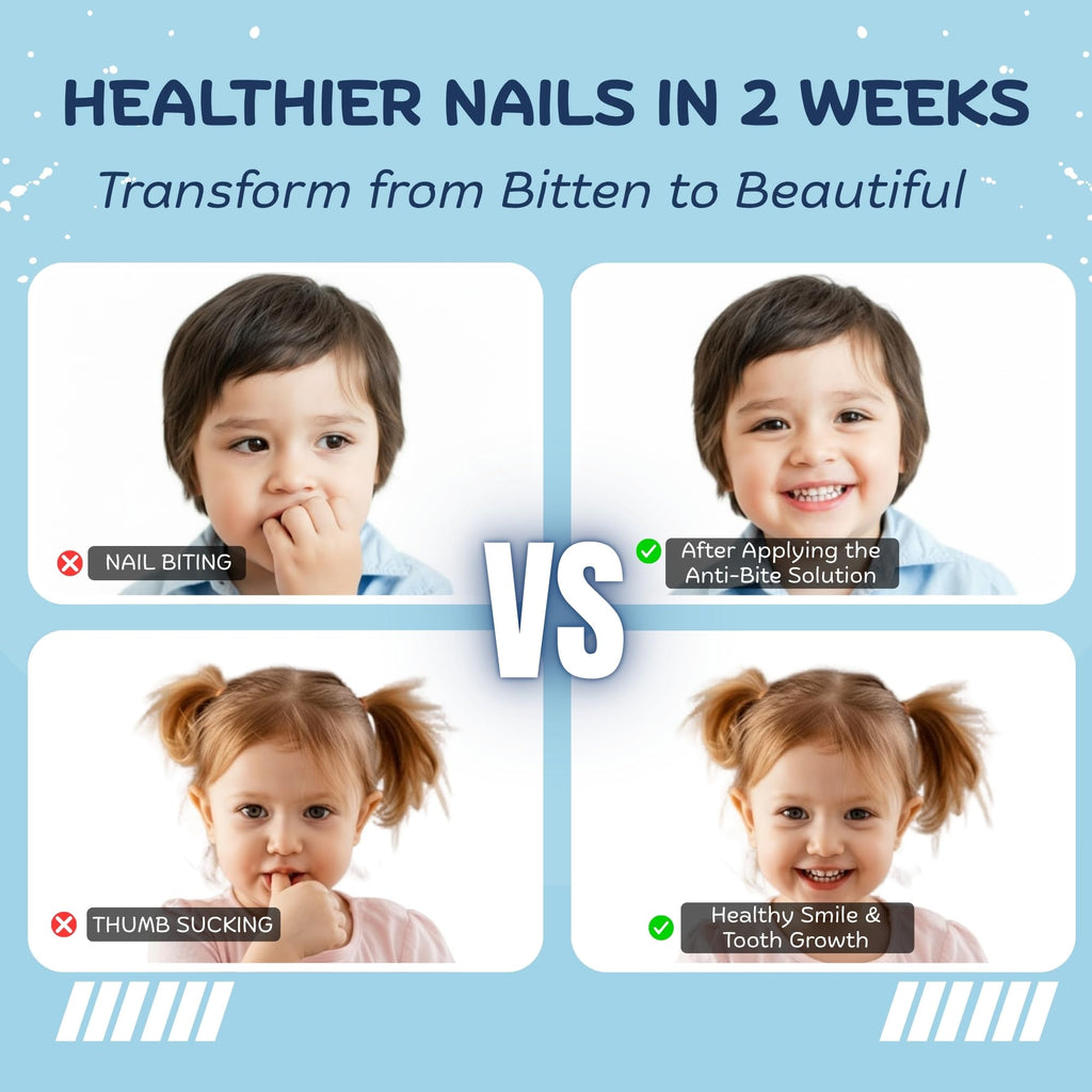 Nipit Honest10 Nail Biting Prevention Pen for Kids – 0.25 oz – USA Made