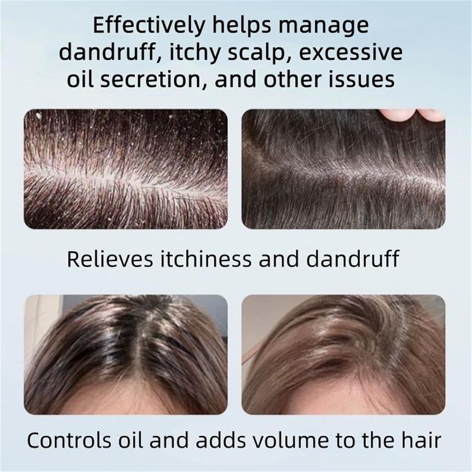 Nipori 10.55 Fl Oz Anti-Dandruff Shampoo – Oil Control, Color Protection & Gentle Cleansing