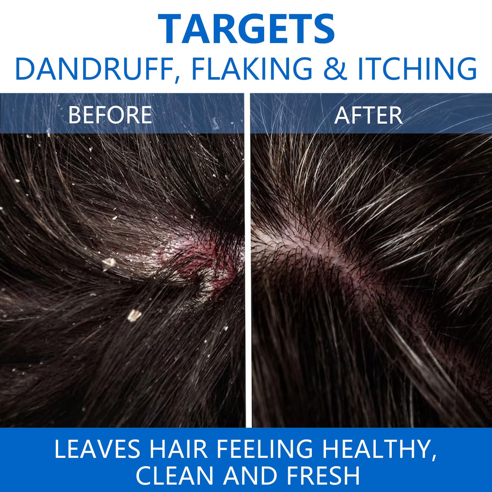 NIPPORI 300ML Selenium Disulfide Anti-Dandruff Shampoo - Oil Control for Men & Women