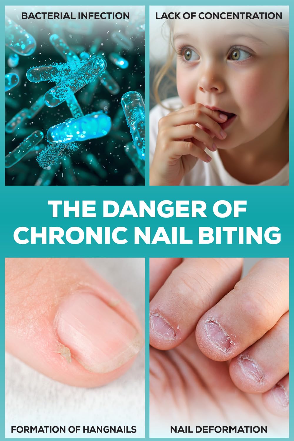NIXXIT Nail Biting Prevention for Kids – Deterrent Pen for Nails, Cuticles & Thumb Sucking