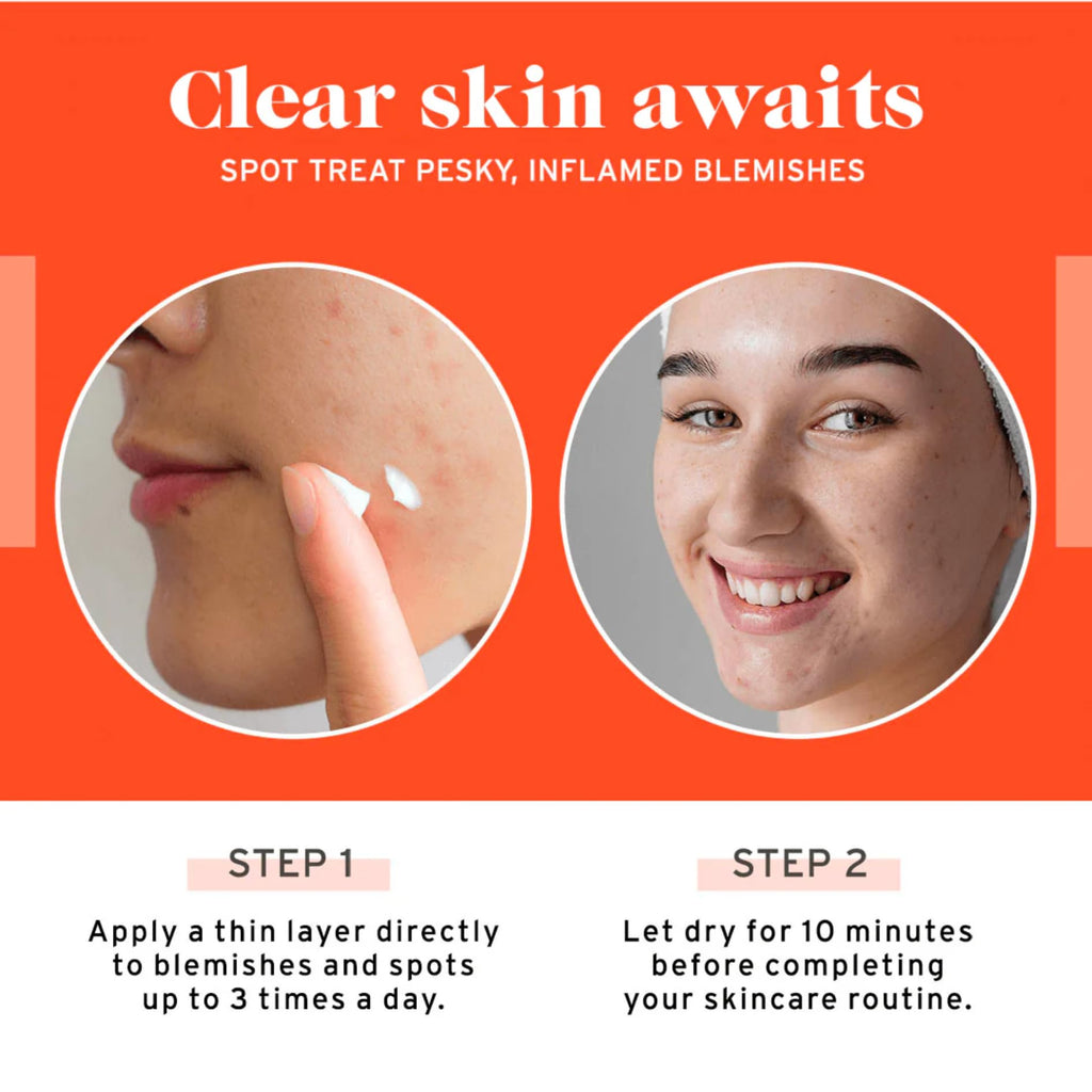 No Bad Stuff Acne Spot Treatment – 2% Salicylic Acid, Chamomile & Aloe Vera (0.5 oz)