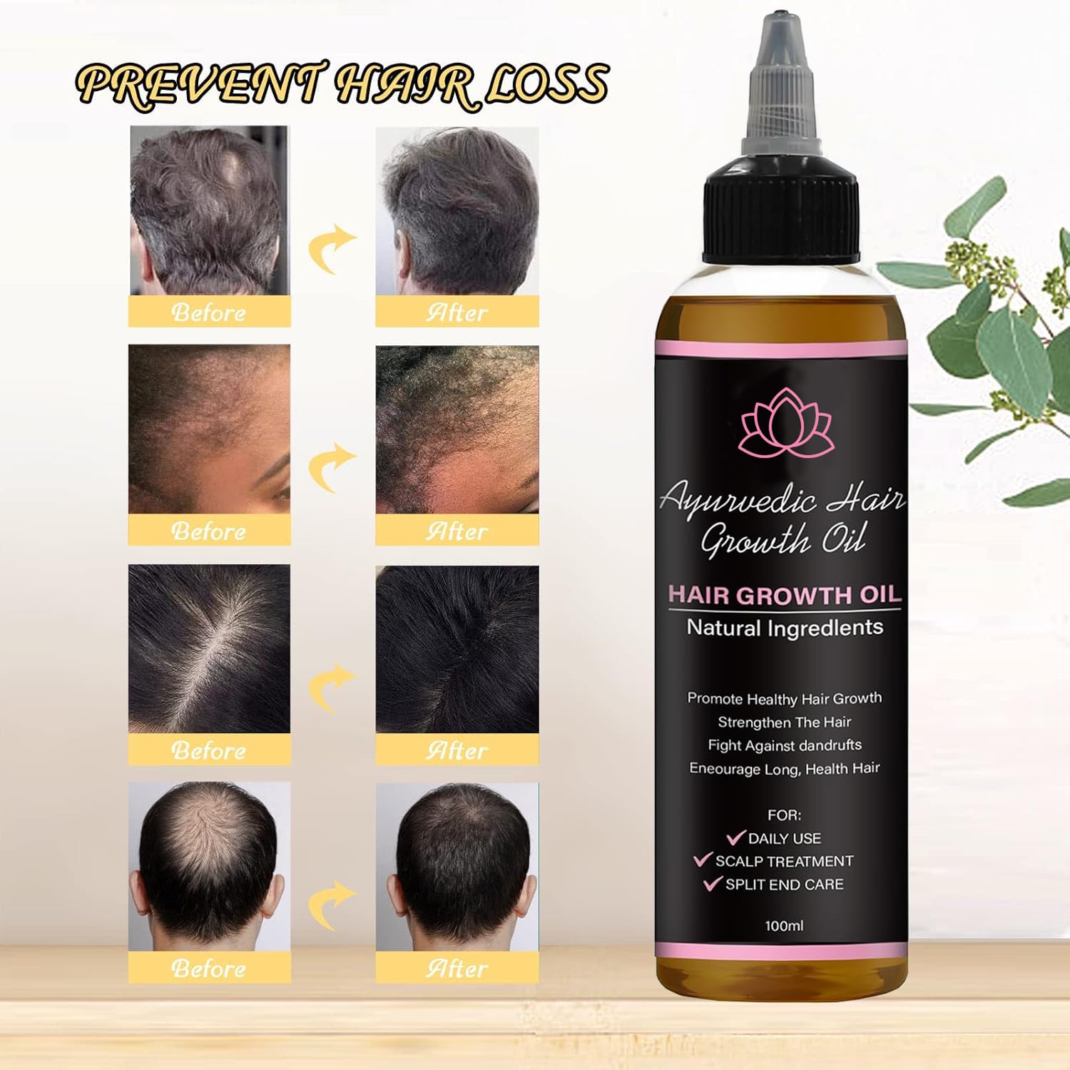 NO BALD Lifewitqueenp Hair Growth Oil – Lightweight Ayurvedic Oil for All Hair Types