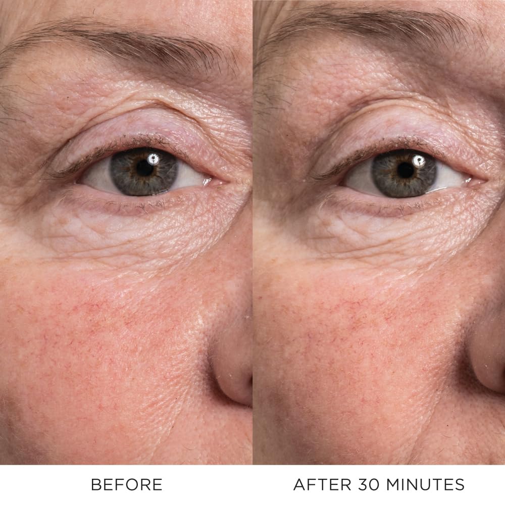 Noble Panacea Eye Lift Concentrate 12 Doses Refill | Luxury Eye Cream for Lifting & Firming