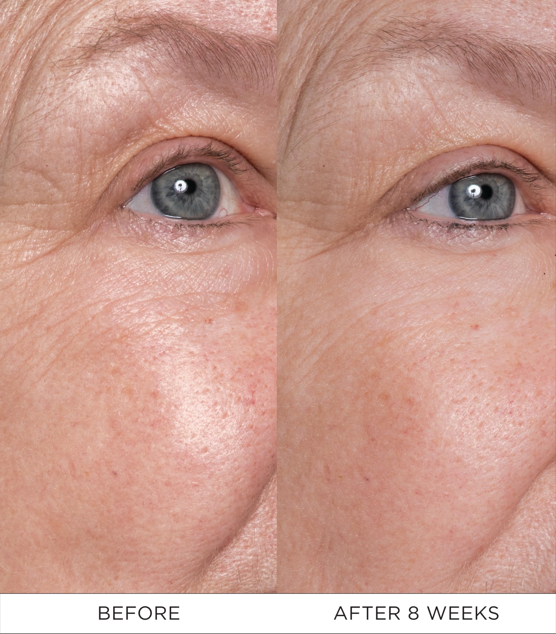 Noble Panacea Eye Lift Concentrate 12 Doses Refill | Luxury Eye Cream for Lifting & Firming